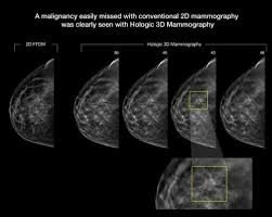 Breast Imaging Equipment Market Development by 2019-2024