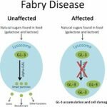 Fabry Disease Treatment Market Development by 2019-2024